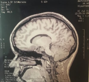 Dr. Boutla's Brain Scan